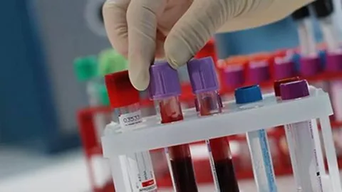 blood analysis Melbourne
